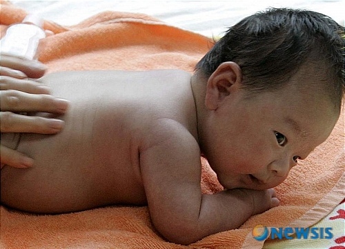 평창군, 진단 받은 초6 이하 대상 '아토피 보습제' 지원