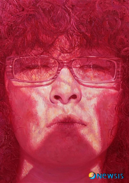 【서울=뉴시스】&nbsp; 백반증은 발생 초기에 치료를 하게 되면 만족할 만한 효과를 얻을 수 있지만 그냥 방치하면 수십년 또는 평생 동안 지속될 수도 있다. 그렇다고 해서 생명을 위협하는 질환은 아니지만 손, 팔 등 겉으로 드러나는 부위의 증상이 심해져 심각한 외모 콤플렉스와 우울증을 겪는 환자들이 많다. <관련기사 있음>/홍남수 듀오피부과 원장 (피부과전문의·의학박사) 