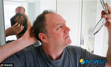 【서울=뉴시스】독일 베를린공대 과학자들이 세계 최초로 줄기세포를 이용해 인공 모낭 배양에 성공해 대머리 치료를 위한 길이 열리게 됐다고 영국 데일리 메일이 18일 보도했다. 사진을 거울로 머리 빠진 부분을 살펴보는 한 남성의 모습. <사진 출처 : 英 데일리 메일 웹사이트>