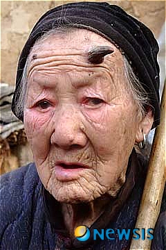【서울=뉴시스】중국 허난성에 살고 있는 장루이팡 할머니(101)의 이마에 6㎝ 크기의 뿔이 나 있다. <사진 출처 : 미 AOL 뉴스닷컴 웹사이트>
