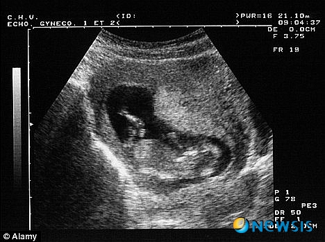 【서울=뉴시스】미 민주당의 린 바흐만 의원이 낙태 반대 법안을 제출하면서 임신 9주 된 태아의 심장 박동 소리를 증거 자료로 제출했다. 사진은 임신한 태아의 초음파 사진 촬영 모습. <사진 출처 : 英 데일리 메일 웹사이트>