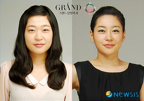 【서울=뉴시스】온라인뉴스팀 = 최근 여름휴가철 성형수요가 더욱 증가하고 있다. <사진=그랜드성형외과 제공> photo@newsis.com 