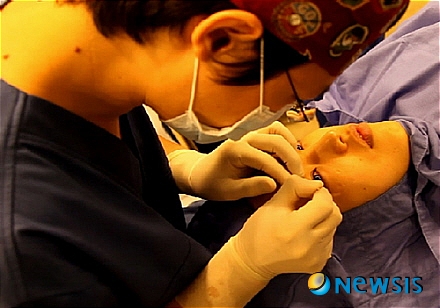 【서울=뉴시스】유희연 기자 = 워너비성형외과 장철호 원장이 밑트임을 시술 중이다.(사진=워너비성형외과 제공)&nbsp; photo@newsis.com