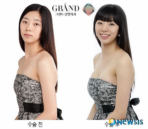 【서울=뉴시스】온라인뉴스팀 = 속옷을 고를 때 무조건 디자인만 보고 구입하기 보다는 자신의 체형에 맞는 제품을 선택하는 것이 무엇보다 중요하다. <사진=그랜드성형외과 제공> photo@newsis.com