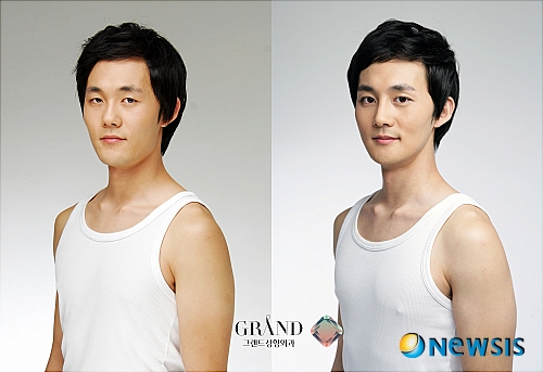 【서울=뉴시스】온라인뉴스팀 = 남자들의 경우 활동량이 많은 청소년기에 축구, 농구 등 운동을 하다 다치거나 기타 이유로 코뼈가 부러지거나 휘는 경우가 종종 있다. <사진=그랜드성형외과 제공> photo@newsis.com