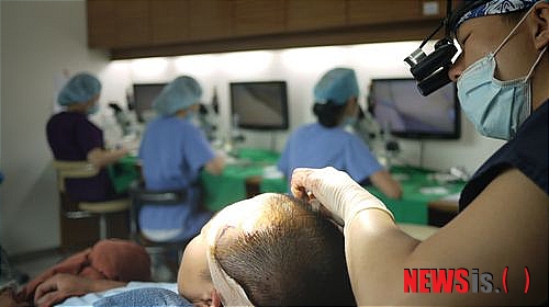 【서울=뉴시스헬스/뉴시스】 NHI 뉴헤어 모발이식 센터 김진오 원장이 모발이식 시술을 진행하고 있다. (사진=NHI 뉴헤어 모발이식 센터 제공) 조진성기자 cjs@newsishealth.com