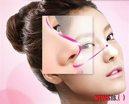 【서울=뉴시스】온라인뉴스팀 = 최근 아이디병원 뷰티플렉스의 '바비라인 코성형'이 코성형의 새로운 바람으로 떠오르고 있다. (사진=아이디병원 제공) photo@newsis.com 