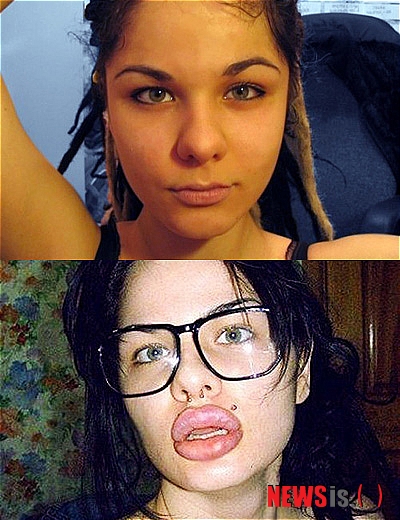 【서울=뉴시스】러시아 상트페테르부르크의 크리스티나 레이(22·여)는 1대 맞는데 40파운드(약 7만원)의 비용이 드는 실리콘 주사를 입술에 100차례나 시술했다. 하지만 "지금의 두께에도 여전히 만족하지 못한다"고 전했다.(사진출처=英 미러지 웹사이트)