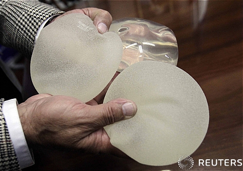 【산호세=로이터/뉴시스】한 의사가 5일(현지시간) 코스타리카 산호세에서 열린 기자회견에서 가슴 확대 수술에 사용되는 실리콘 젤을 보이고 있다. 현재 공업용 실리콘을 가슴확대 수술용 보형물로 판매한 프랑스 회사 PIP사의 대표가 코스타리카에서 추적을 받고 있다.