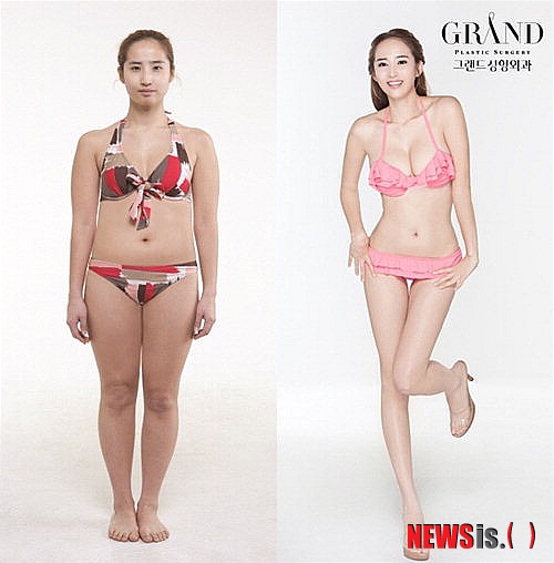 【서울=뉴시스】이재훈 기자 = 2010년 엠넷 서바이벌 오디션 프로그램 '슈퍼스타K 2' 광주 지역예선에 참가한 에로배우 최은(27)이 환골탈태했다. 서울 강남 그랜드성형외과는 전신을 성형한 최은의 수술 전후 사진을 12일 공개했다. 최은은 안면 비대칭과 돌출입, 부정교합이 심하다는 이유로 지난해 양악수술을 받았다. 최근에는 지방흡입술과 자유공간 유방확대술 등을 추가 시술했다. 각 수술비를 합하면 약 6000만원 상당인 것으로 알려졌다. 최은은 '슈퍼스타K 2' 출연 당시 스스로를 에로배우라고 소개했다. 연기자가 꿈이었으나 어머니 수술비 마련을 위해 에로배우로 전향한 사연을 전하며 눈물을 흘리기도 했다. realpaper7@newsis.com