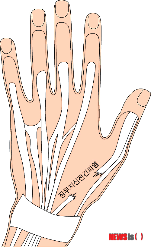 【서울=뉴시스】장무지신전건파열.