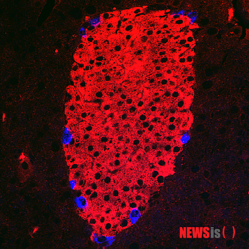 【울산=뉴시스】고은희 기자 = 울산대학교 생명과학부 백승훈(45·분자바이러스학 전공) 교수는 당뇨병 발병에 중요한 췌장의 베타세포 사멸과정을 세계 최초로 밝힌 논문 'ER-stress-induced transcriptional regulation increases protein synthesis leading to cell death(소포체 스트레스로 유도된 유전자 전사조절이 단백질 합성을 증가시켜 세포를 죽게 만든다)'가 세포생물학 분야의 세계 최고 권위지인 '네이처 셀 바이올로지' 5월호에 게재됐다고 22일 밝혔다. 활성화된 인슐린 분비세포 사진이다. (사진=울산대 제공)&nbsp; photo@newsis.com&nbsp; 