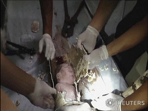 【베이징=로이터/뉴시스】지난 25일 중국 저장(浙江)성 푸장(浦江)현에 있는 한 아파트 화장실에서 소방관과 의료진들이 수세식 변기 아래 하수구에 버려진 신생아를 구조하고 있다. 중국에서 최근 화장실 하수구에 버려진 갓 태어난 신생아가 기적적으로 구출된 사건이 발생한 가운데 네티즌이 강한 분노를 표출하고 있다.