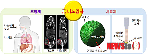 첨부용/미래형 암세포 조영치료제로 사용되는 금 나노입자의 작용메커니즘 