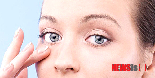 【서울=뉴시스】민기홍 기자 = 눈 밑 지방 제거. 2014.03.03. (사진=세민성형외과 제공)