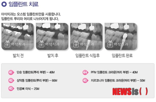 【서울=뉴시스】민기홍 기자 = 아삭치과 가격 정찰제. 2014.04.07. (사진=아삭치과 재공)