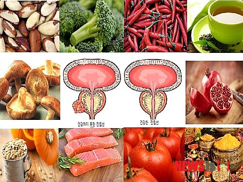 【서울=뉴시스헬스/뉴시스】 건강한 전립선을 위해 챙겨먹어야 하는 가장 좋은 식품 10가지(www.prostate.net 이미지 캡처), 이재승기자 jasonlee@newsishealth.com