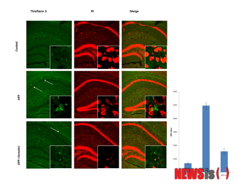 【서울=뉴시스헬스/뉴시스】 28일 경상대학교 치매제어기술개발연구팀이 개발한 치매치료용 천연단백질에 대한 원천기술을 한국파마에 기술이전했다. 사진은 알츠하이머의 주된 현상인 p-tau, 아밀로이드 플라그 등을 현저히 억제시켜 치매 치료효과가 있음을 확인하는 내용이다. (사진=미래창조과학부 제공) 유은정 기자 viayou@newsishealth.com