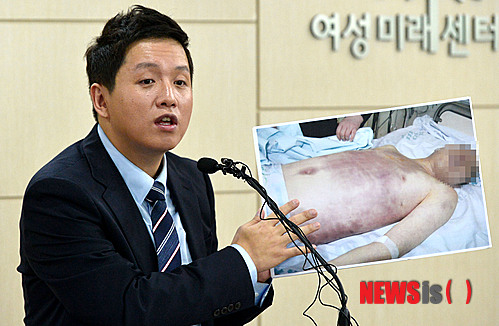 【서울=뉴시스】박동욱 기자 = 31일 오후 서울 영등포구 군인권센터에서 임태훈 소장이 지난 4월 선임병들에게 집단구타 당한 후 사망한 28사단 윤아무개(23) 일병 사망사건과 관련 현안 브리핑 중 일부 사진을 공개하고 있다. 2014.07.31.&nbsp; fufus@newsis.com 