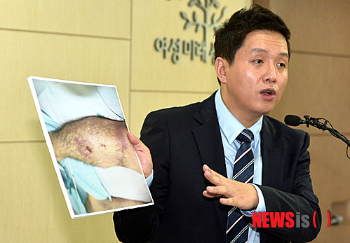 【서울=뉴시스】박동욱 기자 = 31일 오후 서울 영등포구 군인권센터에서 임태훈 소장이 지난 4월 선임병들에게 집단구타 당한 후 사망한 28사단 윤아무개(23) 일병 사망사건과 관련 현안 브리핑 중 일부 사진을 공개하고 있다. 2014.07.31.&nbsp; fufus@newsis.com 