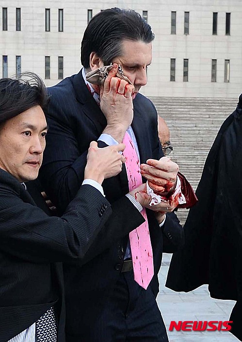 【서울=뉴시스】김진아 기자 = 마크 리퍼트 주한미대사가 5일 오전 서울 종로구 세종문화회관 세종홀에서 열린 민족화해협력범국민협의회 주최 초청강연회에서 괴한의 공격을 받고 피를 흘리며 병원으로 향하고 있다.&nbsp; 마크 리퍼트 대사는 이날 행사에서 한반도 평화와 통일, 그리고 한미관계 발전방향을 주제로 강연을 준비했다. 2015.03.05.&nbsp; bluesoda@newsis.com