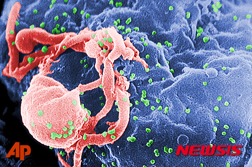 【AP/뉴시스】질병통제예방센터(CDCP)에서 제공한 에이즈(HIV) 바이러스의 세포 표면을 스캔한 전자 현미경 사진. 2018.10.4
