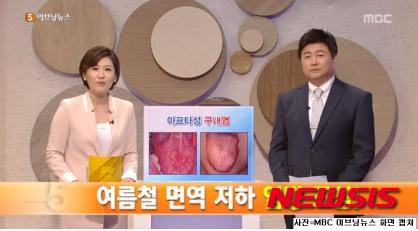 【서울=뉴시스】유희연 기자 = 구내염 완치를 위해서는 몸의 면역력 강화가 답이다. 면역력 강화를 위해서는 과음과 흡연은 삼가고, 균형 잡힌 식단과 면역력 강화에 좋은 음식을 꾸준히 챙겨 먹어야 한다. 면역력 강화에 좋은 대표적인 음식으로는 홍삼이 있다.&nbsp; lovely_jh@newsis.com