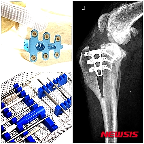 【서울=뉴시스】윤신근 원장 (수의사·윤신근박사애견종합병원) = 개나 고양이의 뼈에 금이 갔는지 부러졌는지, 눈으로 봐서는 알 수 없다. 동물이 다리를 심하게 절면 반드시 X레이를 찍어봐야 하는 이유다.&nbsp; 개의 뒷다리는 골반 골절, 척추 디스크 탈출, 경추 불안정 등으로 약해질 수 있다. 골반 골절은 주로 교통사고 탓이다. 경추의 불안정은 1, 2세의 도베르만핀셔나 그레이트데인에게서 흔하다.&nbsp; 동물육종학 박사·www.dogs.co.kr