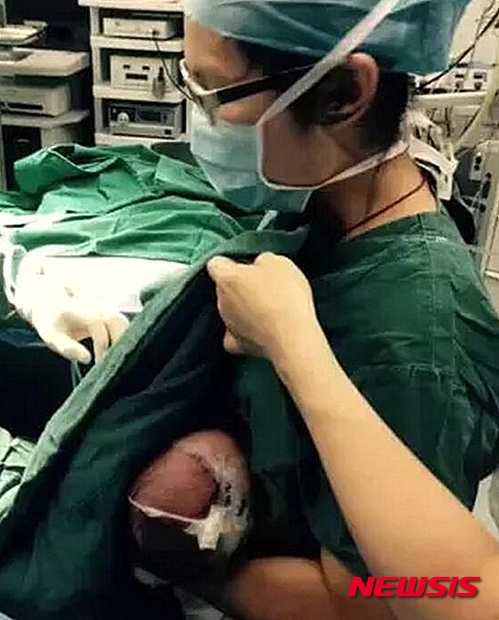 【서울=뉴시스】중국 광둥(廣東)성에서 부분마취를 하고 수술 중인 영아를 달래기 위해 한 간호사가 아이에게 모유 수유를 해 찬사를 받고 있다. 2일 중국 런민왕(人民網)은 광둥선 선전시 광밍신구병원에 근무하는 간호사인 32살 리바오샤(李寶霞)의 이런 선행을 전했다. 리 간호사가 환아에게 수유하는 모습. (사진출처: 선전위생위원회) 2015.10.02