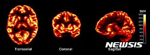 【 AP/뉴시스】미국 예일대 연구팀은 20일(현지시간) 학회지에 발표한 논문을 통해 살아있는 뇌의 신경세포 연결체 시냅스를 촬영하는데 성공했다고 보고했다. 사진은 연구팀이 개발한 기술로 살아있는 뇌를 다양한 각도에서 찍은 사진. 2016.07.21&nbsp;&nbsp; 
