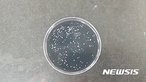 【대구=뉴시스】레지오넬라균 집락(集落)이 형성된 모습. 뉴시스DB. 2025.05.26.&nbsp; photo@newsis.com