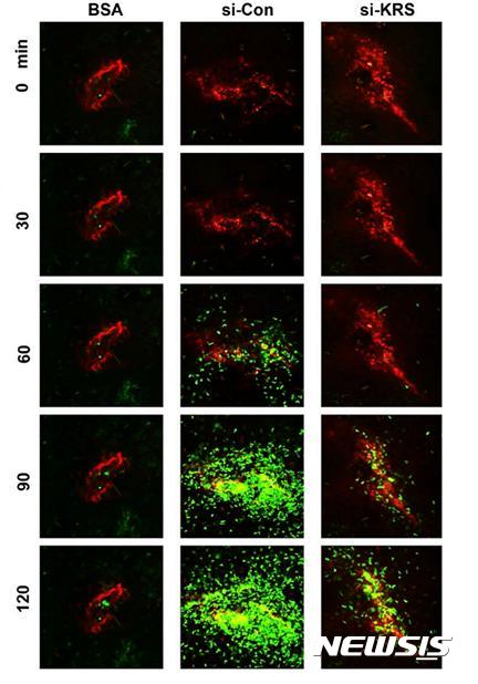 【수원=뉴시스】 차세대융합기술연구원 김성훈 교수팀은 세계 최초로 암 세포를 유발하는 염증 원인물질을 찾아냈다고 3일 밝혔다. 사진은 라이실-tRNA 합성효소 주입 여부에 따른 암 세포 크기 변화 모습. 2017.07.03. (사진=차세대융합기술연구원 제공) photo@newsis.com