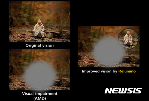 【서울=뉴시스】릴루미노 앱에서 부분시야모드 적용 시 효과를 보여주는 이미지.(사진=삼성전자 제공) photo@newsis.com