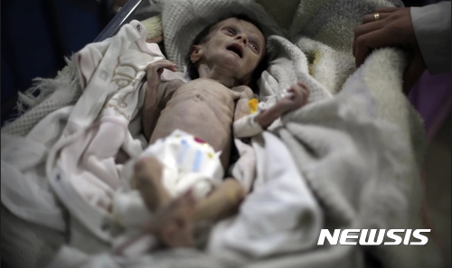 【서울=뉴시스】 영양실조로 지난 22일(현지시간) 생후 1개월 만에 사망한 시리아 아기 사하라 도프다. <출처: 가디언 캡처> 2017.10.24