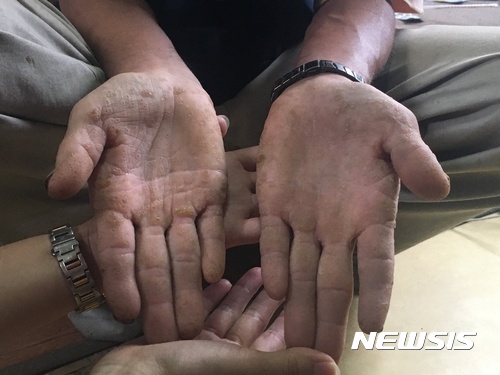 【음성=뉴시스】인진연 기자 = 충북 음성군 맹동면의 한 농장에서 지적장애 3급인 A(63)씨가 20여년 가까이 노동력을 착취당해 온 사실이 뒤늦게 알려졌다. 사진은 중앙장애인 권익옹호기관의 현장 조사 당시 모습. 2017.11.03 (사진=중앙장애인 권익옹호기관) photo@newsis.com