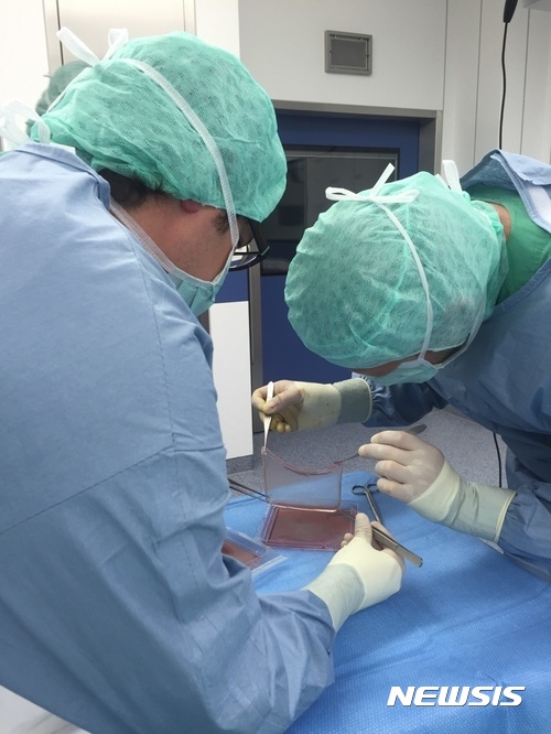 【AP/뉴시스】벨기에 브뤼셀자유대학교의 세드리크 블랑팡 교수 등이 이끄는 공동연구팀이&nbsp; 줄기세포로 인공피부를 만들어내는데 성공했다고 8일(현지시간) 학계에 보고했다. 사진은 독일 보훔에 있는 성 요제프병원의 실험실에서 연구진이 인공 피부를 들어올리고 있는 모습. 유전질환으로 피부의 대부분을 잃은 시리아 소년이 이 병원에서 줄기세포를 이용해 만든&nbsp; 인공피부로 치료를 받고 있다. 2017.11.09