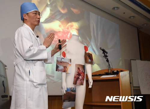 【수원=뉴시스】이정선 기자 = 이국종 경기남부권역외상센터장이 15일 오후 경기 수원 권역외상센터에서 북한군 병사의 2차 수술을 집도한 뒤 브리핑을 열고 있다. 2017.11.15.  ppljs@newsis.com