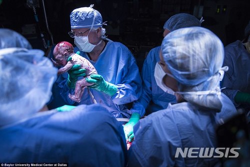 美 기대수명 2년 연속 하락..."약물 과다 복용 때문" 