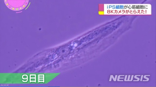 【서울=뉴시스】 유도만능줄기세포(Induced Pluripotent Stem cell·iPS세포)로 배양한 심근세포의 모습. 배양 9일째 심근세포 1개가 박동하는 모습이 카메라에 잡혔다. (사진출처: NHK캡처) 2018.01.08.
