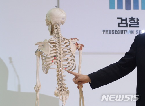【전주=뉴시스】강인 기자 = 25일 전북 전주지검 김한수 차장검사가 '고준희양 학대치사' 사건 수사 결과에 대한 브리핑을 하고 있는 가운데 준희양의 부러진 갈비뼈에 대해 설명하고 있다. 2018.01.25.kir1231@newsis.com