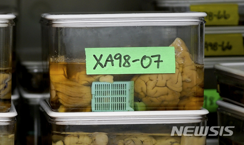 【시카고(미 일리노이주)=AP/뉴시스】미 일리노이주 시카고에 노스웨스턴 대학 연구실에 지난 2월16일 연구진들이 사용하는 인간 뇌 샘플들이 보관돼 있다. 2018.4.10