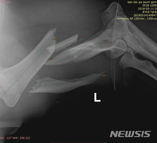 【세종=뉴시스】교통사고를 당한 반달가슴곰 KM53 복합골절 부위를 엑스레이로 촬영한 모습. 2018.05.18.(사진 = 국립공원관리공단 제공)photo@newsis.com