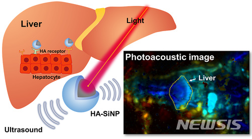【포항=뉴시스】강진구 기자 = 포스텍(총장 김도연)은 창의IT융합공학과 김철홍 교수가 신소재 공학과 한세광 교수와 숙명여대 화공생명공학부 권우성 교수와 공동 연구를 통해 생분해성 히알루론산을 결합한 실리카 나노 입자를 이용해 ‘간’에 대한 광음향 영상을 촬영하는 데 성공했다고 15일 밝혔다.사진은 연구모형도.2018.06.15.(사진=포스텍 제공) photo@newsis.com