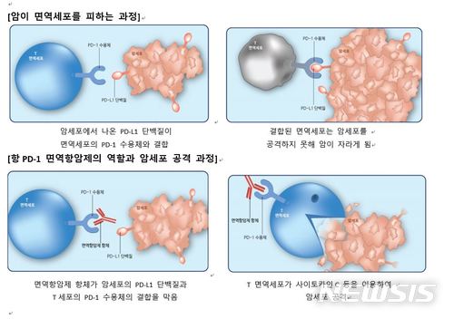 면역항암제, 폐암 1차 치료제로 주목…적응증 확대 사활