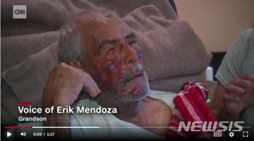 【서울=뉴시스】미국에 사는 가족을 방문한 91세 멕시코인 로돌포 로드리게스가 산책 도중 별다른 이유 없이 행인들로부터 집단구타 당하는 사건이 발생했다. 사진은 9일 CNN 방송을 캡쳐한 것. 2018.07.10