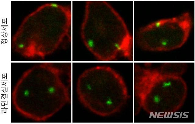 핵막단백질 '라민' 유전자 발현 조절...유전 질환 원인 규명 전망