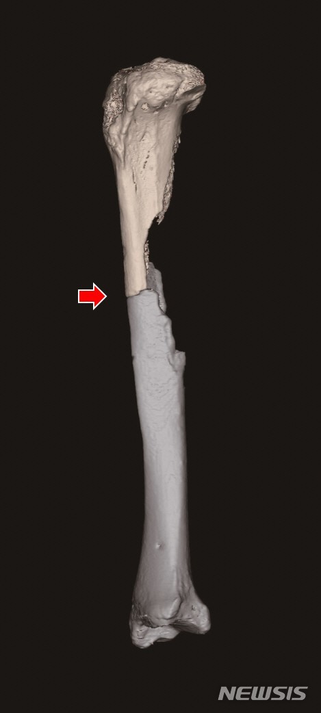 익산 쌍릉 인골, 접합부위