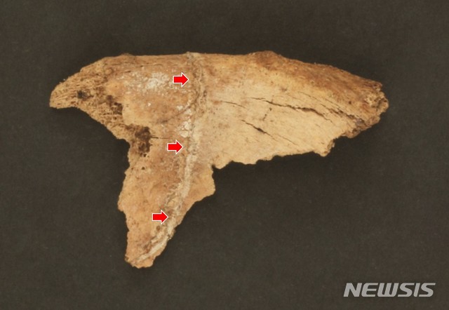 익산 쌍릉 인골, 골절