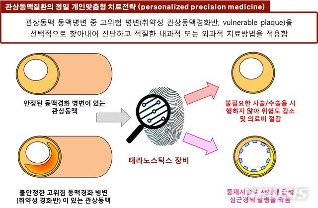 【세종=뉴시스】스마트와이어 시스템 원천기술을 통한 관상동맥질환 정밀 개인맞춤형 치료전략. 2018.08.05.(그림 = 보건복지부 제공)photo@newsis.com