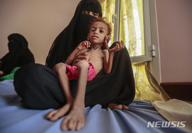 【하자=AP/뉴시스】 국제구호단체 세이브더칠드런(Save the Children)이 예멘 내전으로 2015년 4월부터 2018년 10월까지 5세 이하 어린이 8만4700여 명이 질병이나 굶주림으로 사망한 것으로 추정된다고 20일(현지시간) 발표했다. 사진은 지난 10월 1일 예멘의 도시 하자에서 영양실종에 걸린 아이를 안고 있는 여성. 2018.11.21.